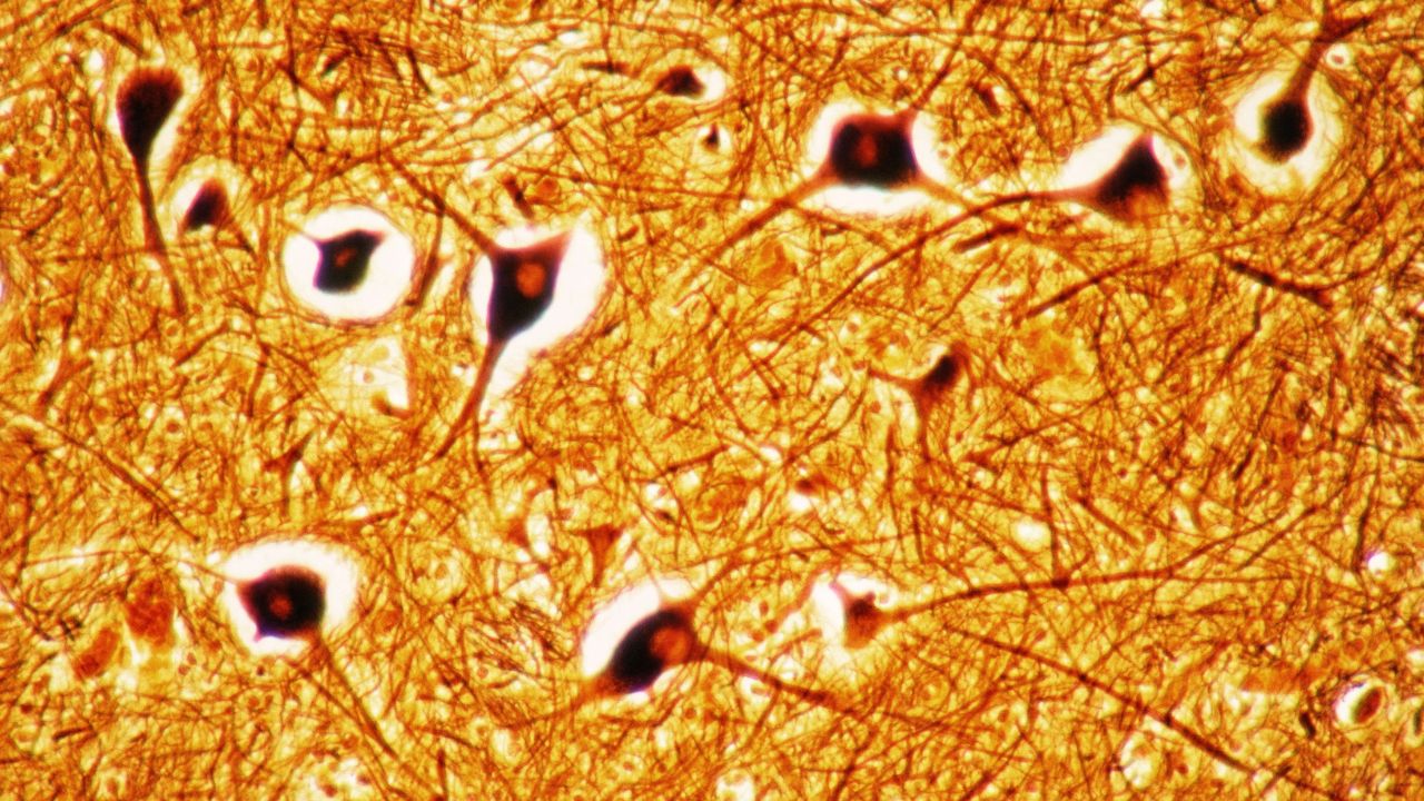 Cellule nervose indispensabili per ricordare oggetti